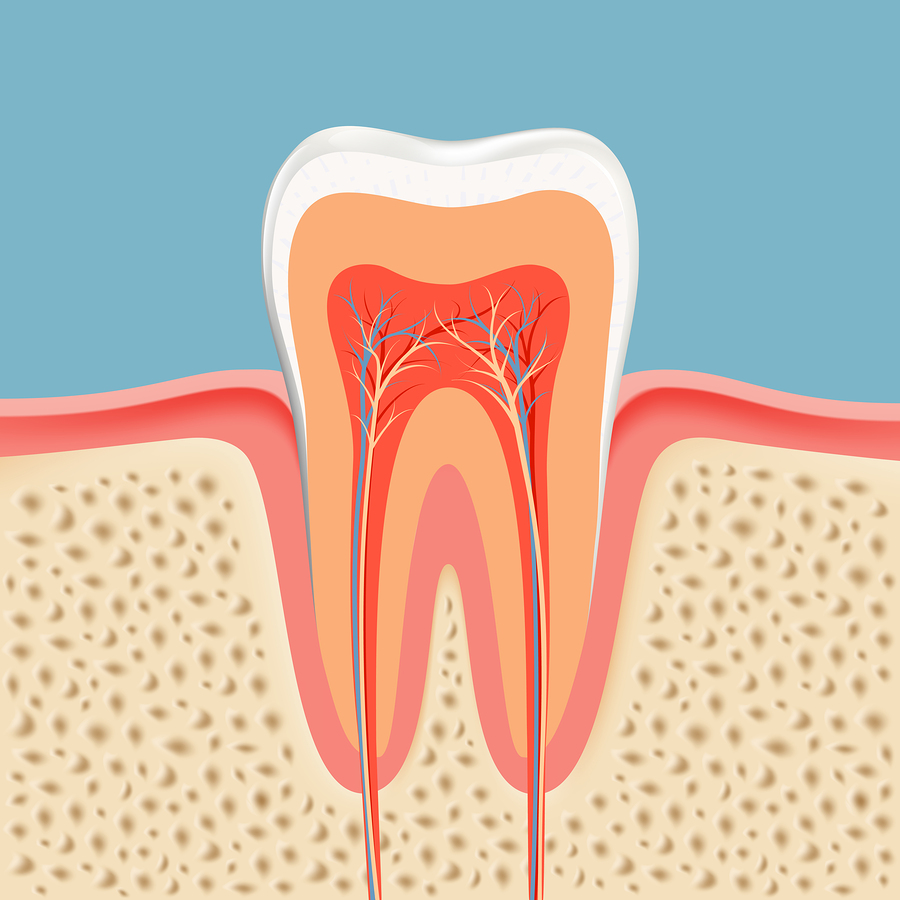 Somerville Root Canal