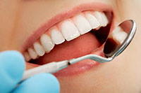 Teeth Whitening Somerville